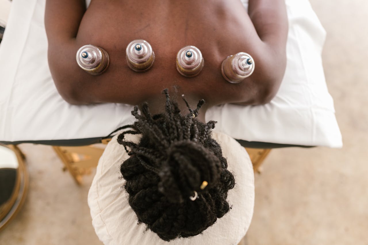 Top view of a cupping therapy session highlighting holistic treatment and relaxation.